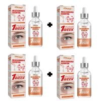 ราคา พร้อมส่ง ครีมบำรุงใต้ตา เซรั่มทาถุงใต้ตา กระชับรอยตีนกา บรรเทาปัญหาต่างๆรอบดวงตา ลบอนุภาคไขมัน (22505626909)