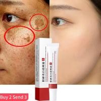 ราคา Whitening Freckle Cream Remove Melasma Cream Remove Dark Spo (21644504064)