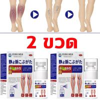 ราคา ครีมทาเส้นเลือดขอด ครีมเส้นเลือด ยาทาเส้นขอด เส้นเลือดขอด รักษาขาให้ ขาสวย ลบเส้นเลือดขอด กลับคืนสุขภาพเท้า Varicose Vein Cream (25003348260)