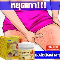 ราคา บรรเทาอาการคัน ครีมแก้คัน าสะเก็ดเงิน ผิวหนังอักเสบ ติดเชื้อรา สะเก็ดเงิน แบคทีเรีย คัน กลาก เกลื้อน ครีมลดอาการคัน (24746468593)