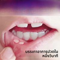 ราคา ยาสำหรับรักษาแผลในปากแบบเฉพาะทาง ยาฆ่าเชื้อแบคทีเรียและไวรัส สำหรับใช้กับทุกเพศทุกวัย บรรจุภัณฑ์พื้นฐาน (24017351913)