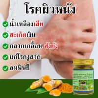 ราคา พลูคาว พญายอ ครีมแก้คัน แก้สะเก็ดเงิน น้ำเหลืองเสีย ครีมทาผิวหนัง ผิวหนังอักเสบ ช่วยได้ ด้วยสมุนไพรธรรมชาติ 100 ทาแก้คัน ผิวหนังทากากเกลื้อน สังฆัง โรคผิวหนัง ผดผื่นคัน แพ้เหงื่อ (24869413864)