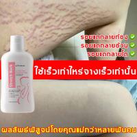 ราคา คุณแม่ 99 พิสูจน์แล้ว ครีมลดรอยแตก 200ml ลดรอยแตกลาย เพิ่มความชุ่มชื้นให้แก่ผิว กระชับผิวให้เรียบเนียน ครีมทาแตกลาย ครีมทารอยแตกขา ครีมกันแตกลาย ครีมทาท้องลาย ครีมทารอยแตก ครีมรอยเเตกลาย ครีมทาหลังคลอ