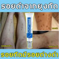 ราคา ครีมทาแผลเป็น ลดรอยเเผลเป็น 30g กรัมลดรอยแผลเป็นจากสิว ลบรอยแผลเป็นจากยุงกัด (24888544415)