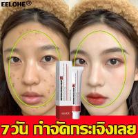 ราคา จุดด่างดำ ครีมกน้าขาวใส ครีมทาผิวกระ กระ ครีมไวท์เทนนิ่ง ครีมทาหน้าขาว ครีมลดฝ้า ครีมลดฝ้า ครีมทาฝ้าหนาๆ ครีมแก้ฝ้า ครีมรักษาฝ้า ครีมทาฝ้า โครีมทาฝ้ากระ ครีมทาฝ้ากระ ครีมลบฝ้า ครีมแก้ฝ้าแท้ๆ ครีมแก้ฝ้