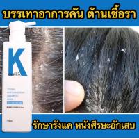 ราคา เน้นสุขภาพหนังศีรษะ OuSHLIAN ยาสระผมแก้รังแค ทำให้ดีขึ้นรังแคและอาการคัน หลีกเลี่ยงผมร่วง ผมเรียบ แชมพูแก้ผมร่วง เชื้อราบนศีรษะ แชมพูแก้รังแค ขจัดรังแค ยาสระผมรังแค แชมพูขิง แชมพูสระผม แชมพูแก้คันศรีษ