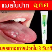 ราคา ครีมทาแผลในปาก แผลร้อนใน ครีมต้านแบคทีเรีย เพื่อสุขภาพช่องปากที่แข็งแรง oral (25005897142)