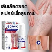ราคา ครีมทาเส้นเลือดขอด ครีมเส้นเลือด ยาทาเส้นขอด เส้นเลือดขอด รักษาขาให้ ขาสวย ลบเส้นเลือดขอด กลับคืนสุขภาพเท้า Varicose Vein Cream (25003348259)