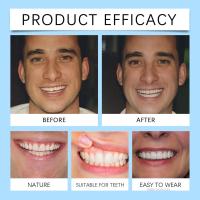 ราคา ชุดฟันปลอม Reline ซิลิโคนความสะดวกสบายพอดีฟันปลอมชุดฟันสำหรับฟันเครื่องสำอางปกป้องฟันของคุณ lb th (24781174681)