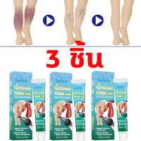 ราคา เปิดตัวสินค้าใหม่ ครีมทาเส้นเลือดขอด ส่งเสริมการไหลเวียนของเลือด รักษาขาให้สวย ครีมเส้นเลือดขอด ขนาด 20กรัม (25227408869)