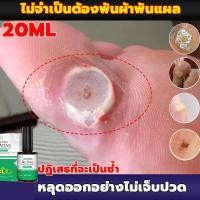 ราคา ทดลองใช้ฟรี 7 วัน จัดส่งสินค้าในกรุงเทพฯ ลบ หูดที่เท้า ตาปลา หูดเส้น หูด แหลม ชิ้นเนื้อ ตาปลาที่เท้า ผิวหนังหนา ตาปลา แผ่นแปะตาปลา พลาสเตอร์ตาปลา พลาสเตอร์ติดตาปลา เห็นผลดีเมื่อใช้ต่อเนื่อง หายจริง (2