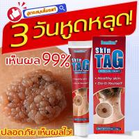 ราคา ลาก่อนหูดดื้อ ครีมทาหูด ผลิตภัณฑ์ไฝ ครีมรักษาปัญหาผิวหนัง สินค้ามาแรงในตอนนี้รักษาได้ทุกระยะ ขี้แมลงวัน ฝ่า กระ สิวหิน รักษาได้ง่ายๆ ด้วยตัวเองที่บ้าน จากสารสกัดจากธรรมชาติ (25274454833)