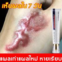 ราคา แผลหายไว ไม่ทิ้งรอย ครีมทาแผลเป็น เจล รอยแผลเป็น รอยสิว รอยดำ รอยแดง ทาแผลเป็นนูน ลบรอยแผลเปน (25269653736)