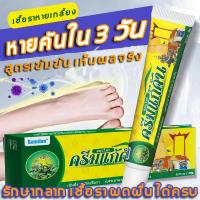 ราคา ปลดปล่อยผิวจากเกลื้อน ครีมลดอาการคัน ครีมแก้คัน สะเก็ดเงินครีม ทาแก้คันครีมทาแก้เชื้อรา ยาทาเชื้อรา ครีมสะเก็ดเงิน รอยแดงหาย ผิวกลับมาเนียนปลอดภัย ไม่มีการระคายเคือง ผิวแห้งและคัน สะเก็ดเงิน เชื้อรา ค