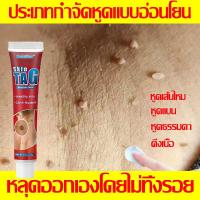 ราคา ขายดี ครีมกำจัดหูด กำจัดหูด อ่อนนุ่มชั้นผิว ส่งเสริมการสร้างเซลล์ผิวใหม่ บรรเทาการอักเสบ ครีมกำจัดไฝ ครีมรักษาหูด ครีมทาหูด (25553653668)