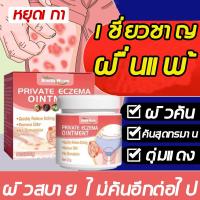 ราคา มีประสิทธิภาพ 100 ครีมแก้คัน ครีมทาบรรเทาอาการคัน 20g ยาทาแก้คัน ครีมบำรุงผิวง่ามขา ครีมแก้คันผิวหนัง ครีมลดอาการคัน ทาแก้คัน บำรุงผิวหนัง ใช้ทาได้ทุกตำแหน่งของร่างกาย ช่วยยับยั้ง เชื้อราเชื้อแบคทีเร 
