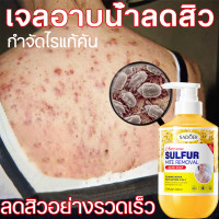 ราคา ครีมอาบน้ำควบคุมสิวที่หลัง ไรฝุ่น บรรเทาอาการคัน ผิวอักเสบ ฟื้นบำรุงผิวเรือนร่าง 500ml สูตรสารส้ม น้ำมันทีทรี (24957685510)
