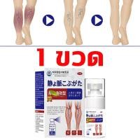 ราคา ไม่ได้ผลคืนเงิน ครีมทาเส้นเลือดขอด ส่งเสริมการไหลเวียนของเลือด รักษาขาให้สวย ครีมเส้นเลือดขอด ขนาด 30กรัม (25009662142)