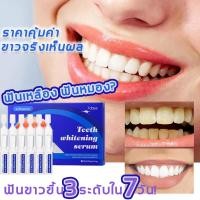 ราคา ยิ้มมั่นใจขึ้นทุกวัน เจลฟอกฟันขาว เซรั่มฟอกฟันขาว ปากกาฟอกฟัน On the glow teeth whitening serum ปากกาฟอกฟันขาว ฟอกฟันขาว 15 นาที ด้วยตนเอง ขาวใสไม่ทำลายเคลือบฟัน สูตรเข้มข้น (25364621784)