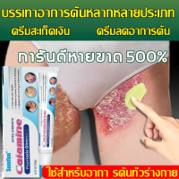 ราคา ครีมบํารุงผิวเพื่อบรรเทาปัญหาผิว อีซีม่า โรคผิวหนัง ผิวหนังแดง บวม คัน อาการแพ้ (25264078704)