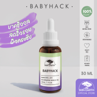ราคา SKIN EARTH BABYHACK BAKUCHIOL X Q10 สกิน เอิร์ธ เบบี้แฮ็ค บาคุชิออล x คิวเท็น (1624860479)