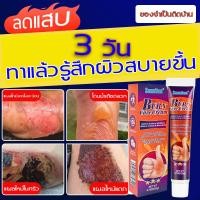 ราคา ครีมทาแผลน้ำร้อนลวก เย็นสบายในไม่กี่นาที ครีมทาแผลไฟไหม้ แผลสด แผลไฟไหม้ น้ำร้อนลวก รอยแผลไฟไหม้ น้ำร้อนลวก พุพอง ฟื้นฟูผิว พร้อมส่งจากไทย (26113206374)
