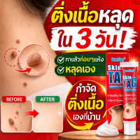 ราคา ลาก่อนหูดดื้อ ครีมทาหูด ผลิตภัณฑ์ไฝ ครีมรักษาปัญหาผิวหนัง สินค้ามาแรงในตอนนี้รักษาได้ทุกระยะ ขี้แมลงวัน ฝ่า กระ สิวหิน รักษาได้ง่ายๆ ด้วยตัวเองที่บ้าน จากสารสกัดจากธรรมชาติ พร้อมส่ง ของแท้ (1267348391