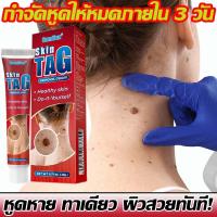 ราคา ทาเดียว หูดหายทันที ครีมรักษาหูด ขี้แมลงวัน หูดตาปลาและติ่งเนื้อ ไฝ แต้ม ทาไฝ ทาขี้แมลงวัน สิวหิน ครีมทาหูด ครีมกำจัดไฝ ครีมกำจัดหูด ผลิตภัณฑ์แต้มไฝ (25738187465)