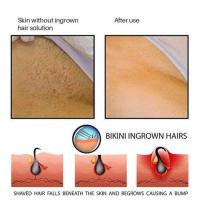 ราคา ครีมหลังโกนหนวด Ingrown Hair Treatment Razor Bump Stopper ป้องกันหลังโกนหนวด ลดรอยแผล บำรุงผิว ครีมหลังโกนหนวด เจล ครีม (26309869752)