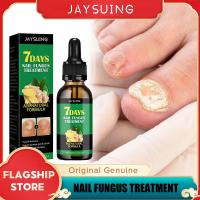 ราคา Jaysuing 7วัน Nail Fungus Treatment Essence Serum Nail Repair Treatment Care Hand And Foot Care Removal Repair Anti Injective Anti Bacterial Nail Fungal Repair Treatment Serum Onychomycosis Paronychia