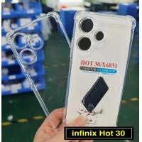 ราคา Case infinix Hot 30 เคสโทรศัพท์ Infinix เคสใส เคสกันกระแทก case Infinix hot 30 (19027730088)
