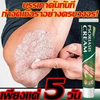 ราคา บรรเทาอาการคัน ครีมลดอาการคัน โรคผิวหนัง เกลื้อน กลาก คัน สมุนไพร แก้คันเรื้อรัง คันในร่มผ้า ครีมแก้คัน สะเก็ดเงินครีม ครีมกำจัดสะเก็ดเงิน ทาแก้คันครีมทาแก้เชื้อรา (25719151022)