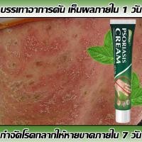 ราคา บรรเทาอาการคัน ผิวหนังทากากเกลื้อน าสะเก็ดเงิน ผิวหนังอักเสบ ติดเชื้อรา สะเก็ดเงิน แบคทีเรีย คัน กลาก เกลื้อน ครีมแก้คัน ครีมลดอาการคัน ทาแก้คัน ครีมลดอาการคัน (25756969847)