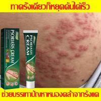 ราคา ขายดี ครีมลดอาการคัน เหมาะสำหรับโรคสะเก็ดเงิน โรคผิวหนังอักเสบ การติดเชื้อจากเชื้อรา การติดเชื้อจากแบคทีเรีย อาการคัน กลาก กลากด่าง เป็นต้น บรรเทาอาการคัน ทาแก้คัน ครีมแก้คัน (25775091757)