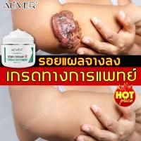 ราคา ALIVER ลดรอยแผลเป็น รอยสิว ครีม ลดรอย แผลไฟไหม้ น้ำร้อนลวก รอยแตกลาย ยาทาแผลเป็น ครีมลดรอยสิว ครีม ลด รอยแผลเป็นจากสิว (7954705225)