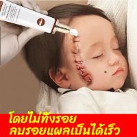 ราคา ครีมลดรอยสิว ยาทาแผลเป็น ครีมลบแผลเป็น ครีมลดแผลเป็น ครีมทาแผลเป็น ครีมลดรอยแผลเป็น ยาลบลอยแผลเป็น ลบรอยแผลเปน (9132788585)