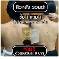 ราคา สบู่รักษาสิวที่หลัง หน้าอก ใบหน้า สูตรแพทย์แผนไทย สบู่ใบชา สบู่ใบชารักษาสิว (15315346084)