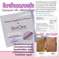 ราคา วิตามินลดรอยสิว Pycnogenol หรือ สารสกัดจากเปลือกสนฝรั่งเศส นำเข้าจาก USA พร้อมส่งในไทย ส่งไวมากจากกรุงเทพ (2998832771)