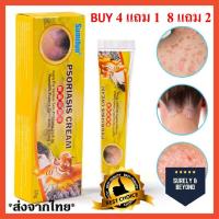 ราคา Tiger 4แถม1 เป็นต้นฉบับครีมทารักษาโรคสะเก็ดเงิน โรคผิวหนังยาทาโรคผิวหนัง เชื้อรา น้ำกัดเท้า กลากเกลื้อน (11311373517)