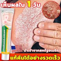 ราคา 【เห็นผลทันที】เป็นต้นฉบับครีมทารักษาโรคสะเก็ดเงิน โรคผิวหนัง ยาทาโรคผิวหนัง เชื้อรา น้ำกัดเท้า กลาก เกลื้อน ผิวหนังอักเสบ (17191409830)