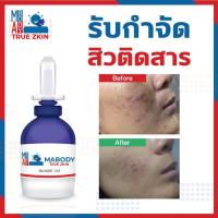 ราคา กำจัดหลุมสิว รอยสิว แผลเป็นสิว จุดด่างดำ Ma Body True Zkin (3382211455)