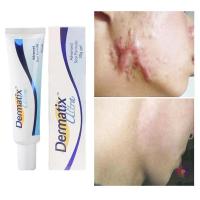 ราคา !ซื้อ1แถม1! Dermatix ยาทาแผลเป็น ลดรอยแผลเป็น รอยสิว ยาทาแผลเป็นนูน ทาแผลเป็น เจลลบรอยแผลเป็น 15 กรัม (22344082516)
