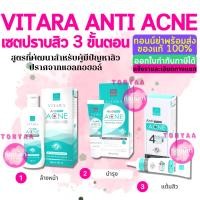 ราคา Vitara Anti Acne Set | เซ็ตปราบสิว ไวทาร่า แอนตี้ แอคเน่ | รักษาสิวจบใน 3 ขั้นตอน (20160551642)