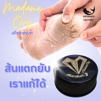 ราคา ครีมทาแก้ส้นแตก บำรุงส้นเท้า มาดามอ้อย ฟุต แคร์ ครีม Madame Ooy Foot Care Cream (15494984579)