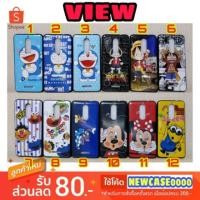 ราคา เคส wiko view / wikoview (955217179)