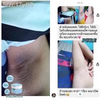 ราคา ℡♛มีเก็บเงินปลายทาง ฟรี!! แท้ 100% PURE ครีมเพียว ครีมทารักแร้ขาว หมดปัญหา รักแร้ดำ กลิ่นตัว 50 g. (12702164094)
