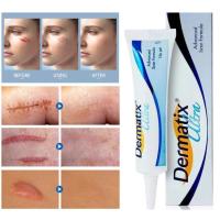 ราคา 【แท้100% 】Dermatix Ultra Gel ยาทาแผลเป็น ลดแผลเป็น รอยสิว แผลไฟไหม้ รอยแผลเป็นจากการผ่าตัด ครีมทาแผลเป็น 15g (25768996777)