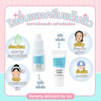 ราคา [ส่งฟรี] โลชั่นและครีมแต้มสิว สำหรับคนมีปัญหาสิว กิฟฟารีน ACTIVE YOUNG (27107686449)