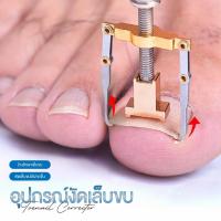 ราคา ที่งัดเล็บขบ อุปกรณ์งัดเล็บขบ ตัวช่วยง้างรักษาเล็บขบ Lifter Ingrown Toenail Tool และที่แคะซอกเล็บ (25442367691)