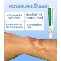 ราคา จัดส่งทันที ซื้อ 2 แถม 1 ฟรีครีมลดรอยแผลเป็น ช่วยลดสิวและรอยแผลเป็นได้อย่างมีประสิทธิภาพ (24742122637)